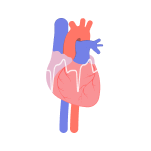 Endocarditis